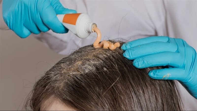 هل تقلل زيوت الشعر