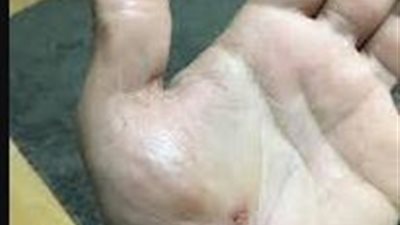 إصابة سائق بقطع كامل بكف اليد على يد شقيق طليقته ببولاق الدكرور