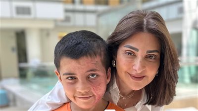 هبة السويدي تروي تفاصيل صادمة عن طفل أُحرق على يد صديقه |تفاصيل 