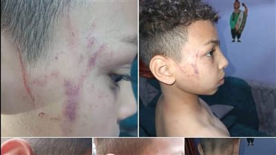 واقعة اعتداء على تلميذ بمدرسة دار السلام الابتدائية بسوهاج