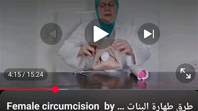 كارثة في المعادي.. طبيبة شهيرة تحول الختان لعملية تجميل (ما القصة؟)