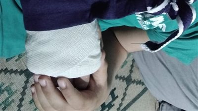 طفل يبكي ساعتين لكسر ذراعه داخل المدرسة دون إسعاف.. وشكوى تثير الجدل