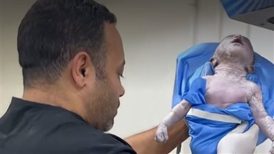«وُلد شبه ميت».. طبيب مصري ينقذ حياة مولود في اللحظات الأخيرة |فيديو