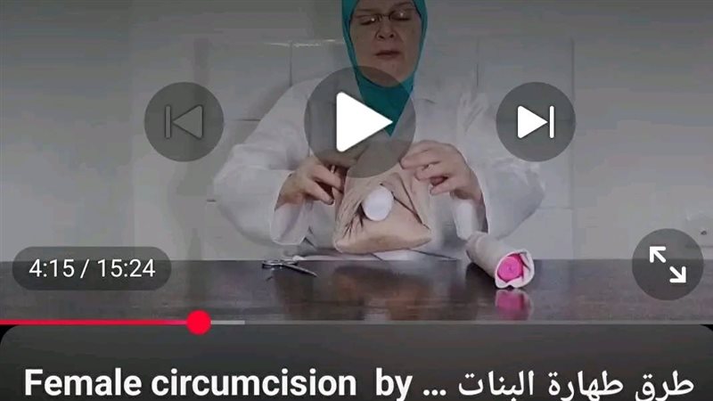 طبيبة شهيرة تحول