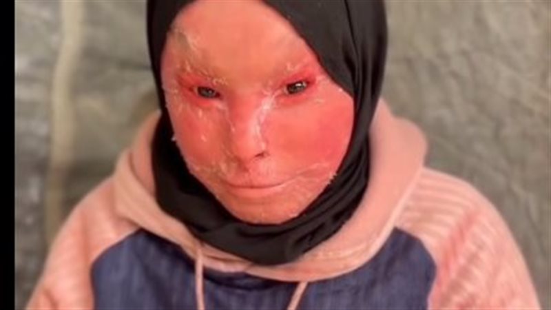 الطفلة شهد