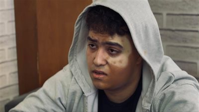 يتحدى مرض البهاق ..أحمد بومبو يتألق ويخطف الأنظار في فيلم 