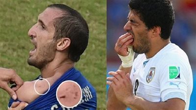 سواريز والعض.. ثلاث لقطات صنعت جدلا لا ينسى في تاريخ كرة القدم