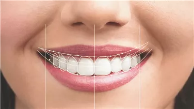 ضحكتك تقولك كل حاجة.. اعرف صحة أسنانك من ابتسامتك بس