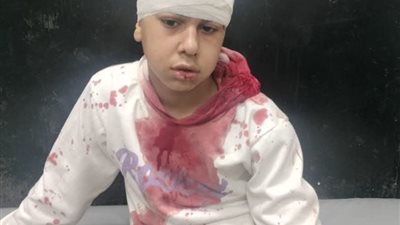 جرس إنذار.. طالب إعدادي يعتدى على زميله بسلاح أبيض في الجيزة