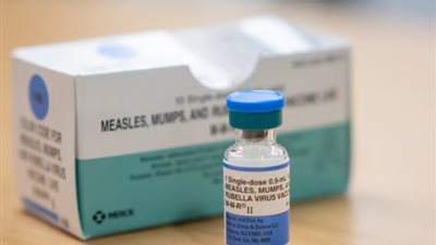 انتشار مخيف.. تفشي الحصبة يثير الذعر في الولايات المتحدة 