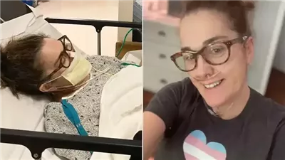 بعد اقتراب فقدان حياتها.. امرأة تنجح في زراعة رئتين بفضل قصر قامتها  