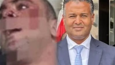 محاكمة المتهم بالاعتداء على مالك جيم «الديزل» بالشيخ زايد 13 مايو