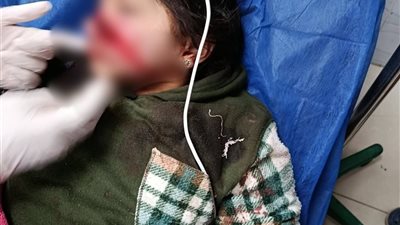 صرخة صامتة من كفر سعد: مأساة طفلة واجهت المرض والجريمة معاً 