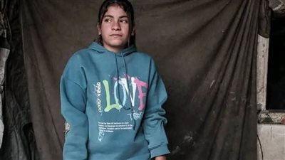 طبيبة المستقبل بلا ساق.. قصة طفلة فلسطينية هزمت اليأس تحت القصف
