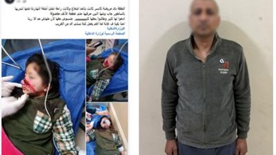 خلاف على محصول ينتهي بإصابة طفلة بآلة حادة في دمياط.. والأمن يضبط المتهم