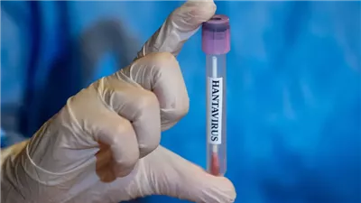 خطوة غير مسبوقة.. تطوير لقاح جديد واعد لفيروس هانتا