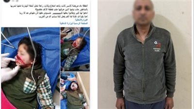 خلاف على أرض زراعية ينتهي بإصابة طفلة.. التحقيق مع عامل تعدى على ابنة شقيقه 