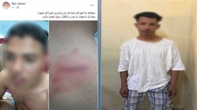 القبض على عاطل تعدى على شاب بالضرب وأحدث إصابته بالجيزة