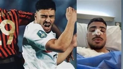 تأكيدًا لنيوز رووم.. جراحة الأنف تبعد محمد إسماعيل وتفسر غضبه بعد النهائي