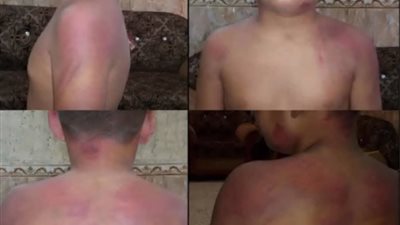 محافظة سوهاج تنفي شائعة تعذيب طفل داخل دار رعاية البنين بالكوثر