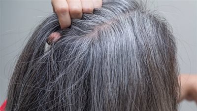 وصفة مجربة لعلاج الشيب المبكر دون استخدام مواد كيميائية