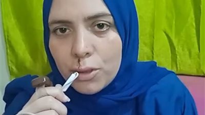 وريني الحكومة هتعمل ايه.. سيدة بالإسكندرية تستغيث بعد سحلهاعلى يد زوج شقيقتها