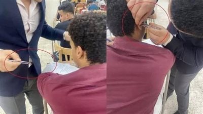 «مشهد صادم داخل اللجنة».. استخراج سماعة غش من أذن طالب حقوق أسيوط بملقاط