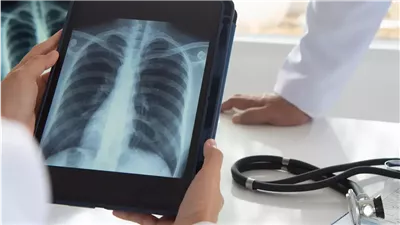 دراسة جديدة.. أدوية إنقاص الوزن قد توقف تطور السرطان