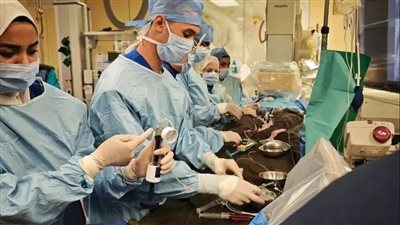 لأول مرة وبأقل تكلفه..«فونتان عبر القسطرة» لإنقاذ قلوب الأطفال بدون جراحة|تفاصيل