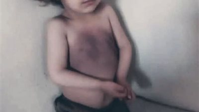 «ما ذنب هذا الطفل؟».. قصة متداولة تشعل الغضب عبر مواقع التواصل