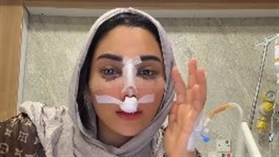 البلوجر أم خالد تعلن خضوعها لعملية تجميل في الأنف وتنشر فيديو بعد العملية