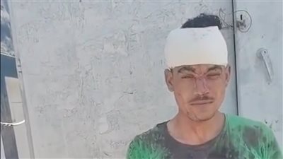 الأمن يفحص واقعة إصابة شخص بـ38 غرزة في الرأس إثر مشاجرة عائلية بالدقهلية