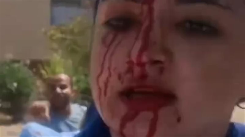 ضبط شخص لاعتدائه