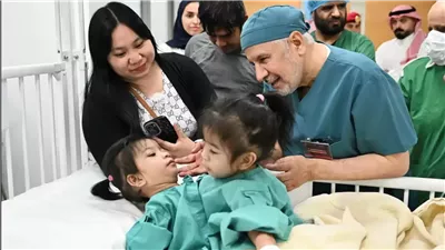 الرياض تسطر إنجازًا طبيًا.. بدء عملية فصل التوأم الفلبيني 