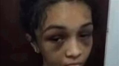  واقعة تعذيب لطفلتين تثير غضبًا واسعًا وتعيد الجدل حول ملف الحضانة 