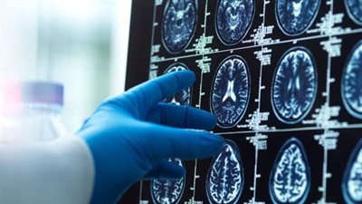 اكتشاف عصبي قد يغيّر فهم التركيز.. خلايا قديمة في الدماغ تتحكم بالانتباه
