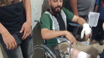 ارتفاع مصابي عقر كلب بالمنوفية لـ 12 حالة والأهالي تطالب المسئولين بالتدخل