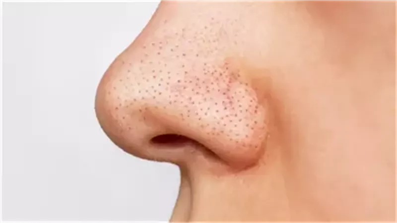 أسباب ظهور الرؤوس