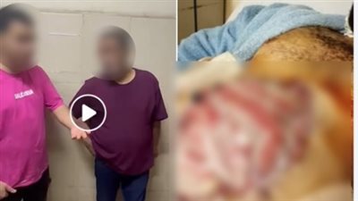 صورة لجرح المتوفى.. الداخلية تكشف حقيقة وفاة متهم داخل حجز بالجيزة