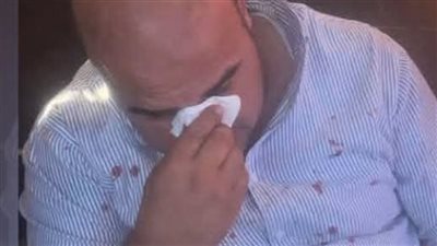 نائب رئيس مدينة رأس البر لـ «نيوز رووم»: الاعتداء لن يوقف حملات الإشغالات