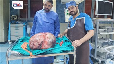 رئيس جامعة المنيا: نجاح استئصال ورم يزن 24 كيلو يؤكد كفاءة مستشفياتنا وريادتها