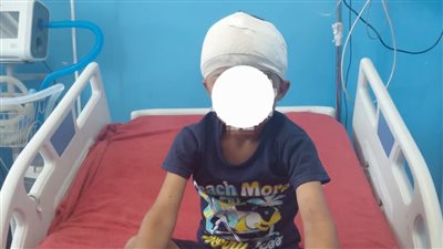 فريق طبي بجامعة سوهاج ينجح في استخراج رصاصة من مخ طفل وإنقاذه دون مضاعفات