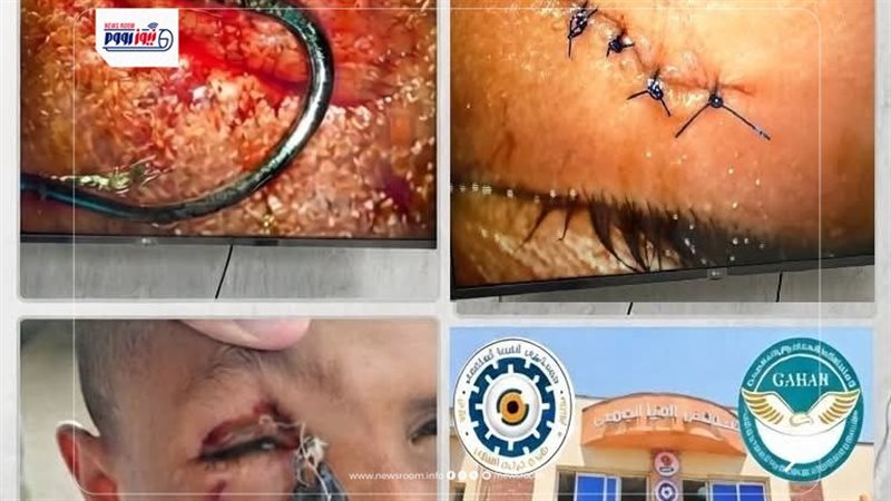 صورة من العملية في