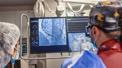 يؤخّر الحاجة للتدخل الجراحي.. اختبار دواء مبتكر لعلاج تضيّق الصمام الأورطي