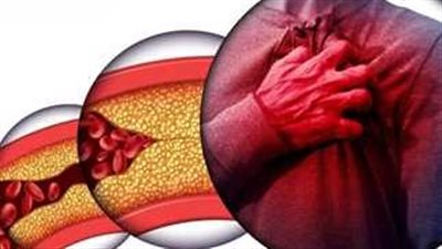 بهار منزلي بسيط يساهم في خفض الكولسترول الضار وتحسين صحة القلب