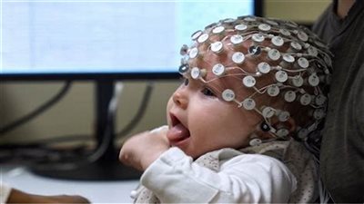 دراسة جديدة للكشف عن التوحد لدى الأطفال فى عمر 6 أشهر