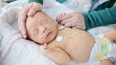 دراسة: فقر الدم قد يزيد من أمراض القلب لدى الأطفال حديثي الولادة