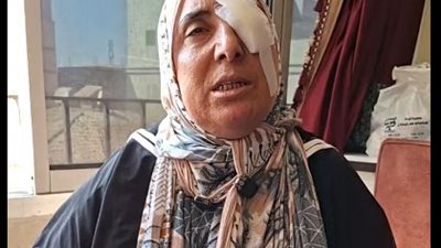 سماح تفقد عينها بسبب خلاف على الميراث.. اعتدى عليها أشقاؤها بعد مطالبتها بحقها