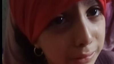 «طفلة عمرها 7 سنين وجسمها غرقان دم».. طفلة تستغيث: «أبويا ضربني وعورني في راسي»