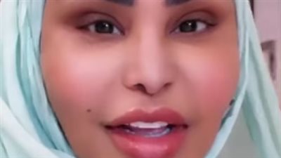 أول ظهور للمطربة أحلام بعد نجاح عملية شد الوجه |فيديو